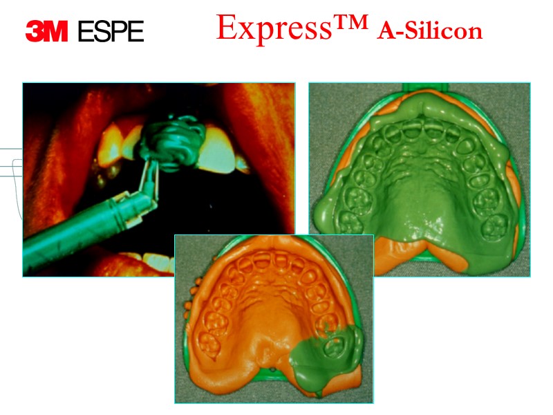 Express™ A-Silicon